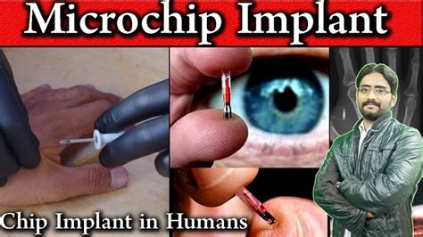 sholar essay on rfid chips implanted|The Human RFID Implants Introduce a New Level of Human.